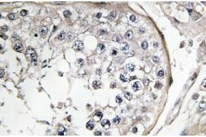 Image no. 1 for anti-Phosphoinositide 3 Kinase, p85 alpha (PI3K p85a) antibody (ABIN317803) (PIK3R1 antibody)