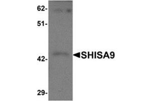 Western blot analysis of SHISA9 in rat brain tissue lysate with SHISA9 antibody at 1 μg/ml. (Shisa9 antibody  (Center))