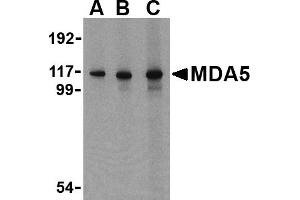 Western blot analysis of MDA5 in Daudi cell lysate with MDA5 antibody at (A) 1, (B) 2 and (C) 4 µg/mL. (IFIH1 antibody  (C-Term))