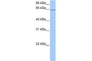 WB Suggested Anti-C2orf42 Antibody Titration: 0. (C2orf42 antibody  (C-Term))
