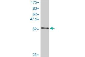 Western Blot detection against Immunogen (37. (DIRAS3 antibody  (AA 130-229))