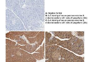 Immunohistochemistry with anti-IL-6 antibody showing cytoplasmic IL-6 staining in mouse pancreas exocrine and endocrine sections with islets of Langerhans at 10x and 20x (B & C). (IL-6 antibody)
