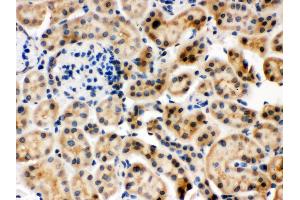 Immunohistochemistry (Paraffin-embedded Sections) (IHC (p)) image for anti-Heat Shock 70kDa Protein 8 (HSPA8) (AA 520-614) antibody (ABIN3043852) (Hsc70 antibody  (AA 520-614))