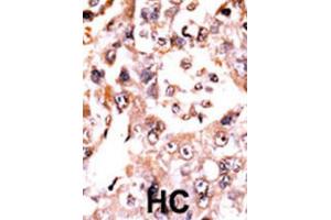 Immunohistochemistry (IHC) image for anti-Dual Specificity Phosphatase 3 (DUSP3) antibody (ABIN3003774)