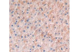 Used in DAB staining on fromalin fixed paraffin- embedded Kidney tissue (SLC25A20 antibody  (AA 1-301))