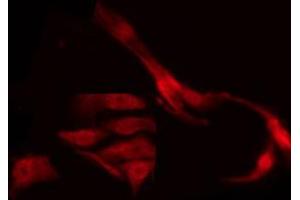 ABIN6267291 staining MDA-MB-435 by IF/ICC. (p53 antibody  (pSer9))