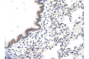 Rabbit Anti-VDAC3 antibody Catalog Number: ARP35180_P050  Paraffin Embedded Tissue: Human Lung cell  Cellular Data: Epithelial cells of renal tubule Antibody Concentration:  4. (VDAC3 antibody  (N-Term))