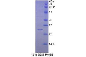 SDS-PAGE (SDS) image for Cytochrome P450, Family 19, Subfamily A, Polypeptide 1 (CYP19A1) (AA 196-373) protein (His tag) (ABIN2120619)