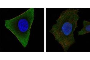 Confocal immunofluorescence analysis of Hela (left) and HepG2 (right) cells using JAK3 mouse mAb (green). (JAK3 antibody)