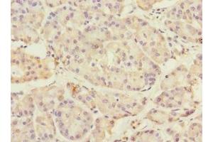 Immunohistochemistry of paraffin-embedded human pancreatic tissue using ABIN7172973 at dilution of 1:100 (TMED1 antibody  (AA 24-194))