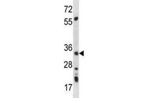 AMPK beta 2 antibody western blot analysis in mouse kidney tissue lysate (PRKAB2 antibody  (AA 3-33))