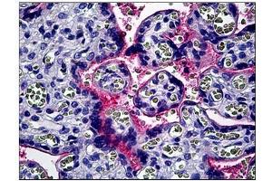 Human Placenta: Formalin-Fixed, Paraffin-Embedded (FFPE) (CD51 antibody  (C-Term))