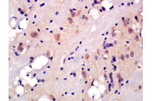 Formalin-fixed and paraffin embedded rat brain labeled with Rabbit Anti-5HT2A Receptor/SR-2A Polyclonal Antibody, Unconjugated (ABIN1386671) at 1:200 followed by conjugation to the secondary antibody and DAB staining (HTR2A antibody  (AA 51-150))