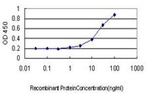 Detection limit for recombinant GST tagged SOX30 is approximately 1ng/ml as a capture antibody. (SOX30 antibody  (AA 644-753))