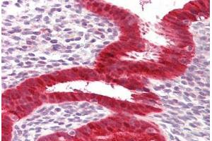 Anti-RIG-1 / RIG-I antibody IHC staining of human uterus. (DDX58 antibody  (AA 200-250))