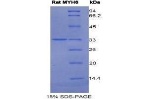 SDS-PAGE (SDS) image for Myosin Heavy Chain 6, Cardiac Muscle, alpha (MYH6) (AA 419-666) protein (His tag) (ABIN1525528)