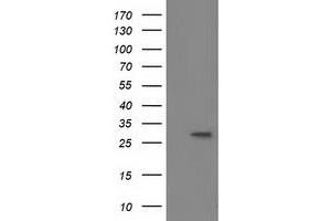 HEK293T cells were transfected with the pCMV6-ENTRY control (Left lane) or pCMV6-ENTRY BIN3 (Right lane) cDNA for 48 hrs and lysed. (BIN3 antibody)