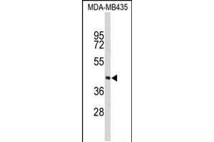 Western blot analysis of PHYH Antibody in MDA-MB435 cell line lysates (35ug/lane) (PHYH antibody  (N-Term))