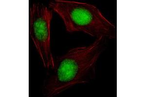 Immunofluorescence (IF) image for anti-Sterol Regulatory Element Binding Transcription Factor 2 (SREBF2) antibody (ABIN2995769) (SREBF2 antibody)