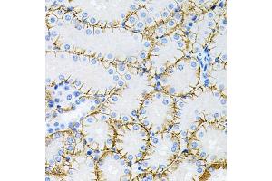 Immunohistochemistry of paraffin-embedded mouse kidney using Tau antibody (ABIN3021441, ABIN3021442, ABIN3021443 and ABIN6215045) at dilution of 1:100 (40x lens). (MAPT antibody  (AA 1-100))
