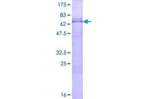 Image no. 1 for Kruppel-Like Factor 12 (KLF12) (AA 1-402) protein (GST tag) (ABIN1308739) (KLF12 Protein (AA 1-402) (GST tag))