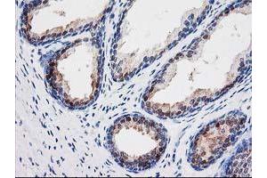 Immunohistochemical staining of paraffin-embedded Human prostate tissue using anti-SEC14L2 mouse monoclonal antibody. (SEC14L2 antibody)