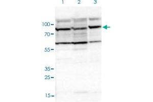 Western blot analysis of Lane 1: Human cell line RT-4; Lane 2: Human cell line U-251MG sp; Lane 3: Human plasma (IgG/HSA depleted) with EIF4ENIF1 polyclonal antibody  at 1:100-1:250 dilution.