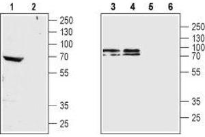 Western blot analysis of rat brain membrane (lanes 1 and 2), mouse brain membrane (lane 3 and 5) and SH-SY5Y cell lysate (lanes 4 and 6): - 1,3,4. (CHRM4 antibody  (AA 330-340))