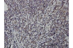 Immunoperoxidase of monoclonal antibody to IKBKE on formalin-fixed paraffin-embedded human tonsil. (IKKi/IKKe antibody  (AA 541-640))