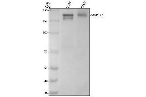 Western blot analysis of MAP3K4 using anti-MAP3K4 antibody (ABIN7605489).