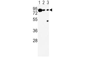 Western Blotting (WB) image for anti-Dopachrome Tautomerase (DCT) antibody (ABIN5024316) (DCT antibody)