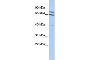 WB Suggested Anti-ZNF471 Antibody Titration:  0.