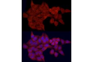 Immunofluorescence analysis of HeLa cells using SLC27 Rabbit pAb (2847) at dilution of 1:100 (40x lens). (SLC27A1 antibody  (AA 347-646))