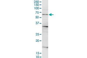 CSGALNACT2 MaxPab rabbit polyclonal antibody. (CSGALNACT2 antibody  (AA 1-542))