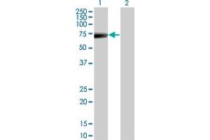 Western Blot analysis of KRT5 expression in transfected 293T cell line by KRT5 monoclonal antibody (M08), clone 1A12. (Cytokeratin 5 antibody  (AA 1-590))