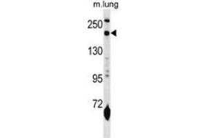 Western blot analysis in mouse lung tissue lysates (35ug/lane) using CD206 / MRC1 Antibody (N-term). (Macrophage Mannose Receptor 1 antibody  (N-Term))