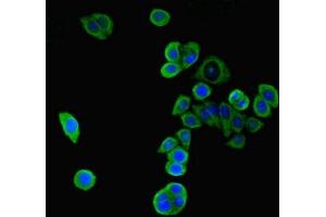 Immunofluorescent analysis of PC-3 cells using ABIN7169234 at dilution of 1:100 and Alexa Fluor 488-congugated AffiniPure Goat Anti-Rabbit IgG(H+L) (WNK4 antibody  (AA 828-1106))