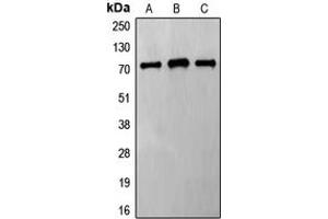 Western blot analysis of Frizzled 8 expression in HeLa (A), Jurkat (B), MCF7 (C) whole cell lysates. (FZD8 antibody  (C-Term))