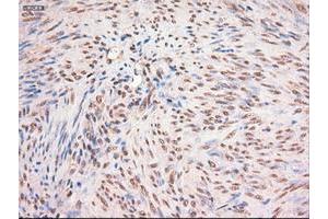 Image no. 1 for anti-Myc Proto-Oncogene protein (MYC) antibody (ABIN1497013) (c-MYC antibody)