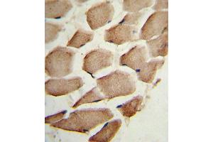 Immunohistochemistry (IHC) image for anti-Actin Related Protein 2/3 Complex, Subunit 1A, 41kDa (ARPC1A) antibody (ABIN3002659) (ARPC1A antibody)