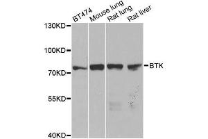 Western blot analysis of extracts of various cell lines, using BTK antibody. (BTK antibody  (AA 173-272))