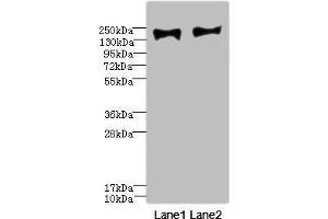 Western blot All lanes: MRC2 antibody at 3. (MRC2 antibody  (AA 120-300))