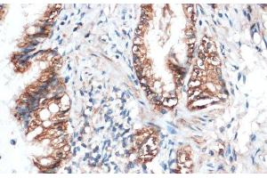 Immunohistochemistry of paraffin-embedded Rat lung using Aquaporin 4 Polyclonal Antibody at dilution of 1:100 (40x lens). (Aquaporin 4 antibody)
