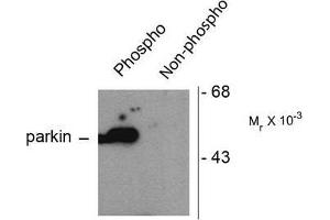 Image no. 1 for anti-Parkinson Protein 2, E3 Ubiquitin Protein Ligase (Parkin) (PARK2) (pSer101) antibody (ABIN372697) (Parkin antibody  (pSer101))
