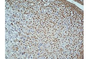 Immunohistochemistry (IHC) image for anti-Antigen Identified By Monoclonal Antibody Ki-67 (MKI67) (AA 1201-1300) antibody (ABIN677858)