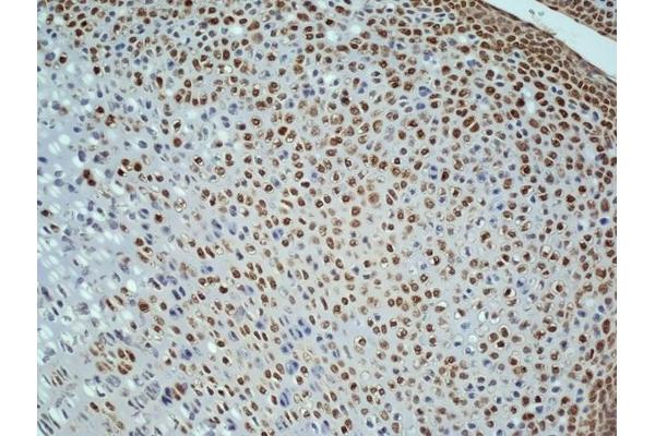 Ki-67 antibody  (AA 1201-1300)