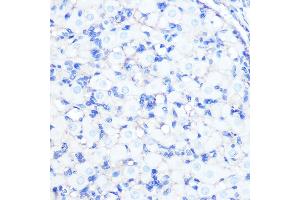 Immunohistochemistry of paraffin-embedded rat ovary using Na+/K+-ATPase Rabbit mAb (ABIN7270390) at dilution of 1:100 (40x lens). (ATP1A1 antibody)