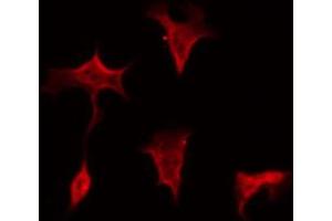 ABIN6269399 staining 293 by IF/ICC. (GRLF1 antibody  (Internal Region))