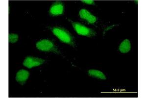 Immunofluorescence of monoclonal antibody to RNF113A on HeLa cell. (RNF113A antibody  (AA 1-343))