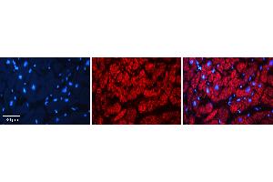 Immunohistochemistry (IHC) image for anti-Eukaryotic Translation Initiation Factor 3 Subunit E (EIF3E) (Middle Region) antibody (ABIN2783260)